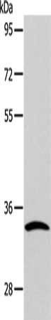 CASP6 Antibody