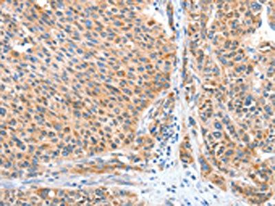 CASP7 antibody