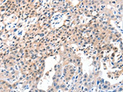 CASP7 Antibody