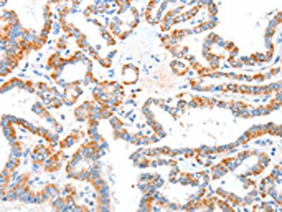 CASP7 Antibody