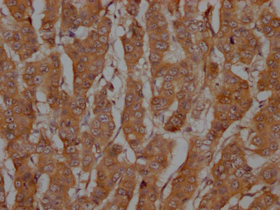 CASP3 Recombinant Monoclonal Antibody