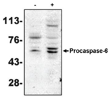 Mouse anti Human Caspase-6 Antibody