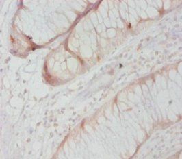 Caspase 8 antibody