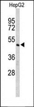 Caspase 8 antibody