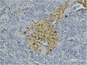 CASP8 Monoclonal Antibody