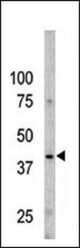 Caspase 9 (phospho-Ser196) antibody