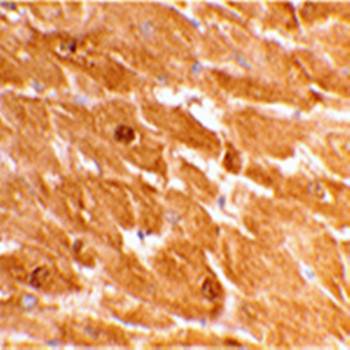 Caspase2 Antibody (Large)