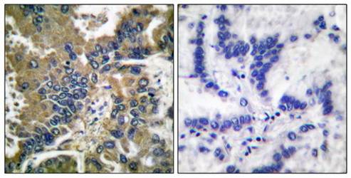 Caspase 1 (Cleaved-Asp210) Antibody