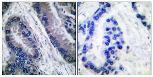 Caspase 1 (Cleaved-Asp210) Antibody