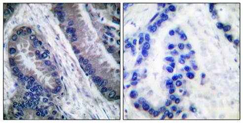 Caspase 1 (Cleaved-Asp210) antibody