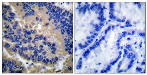 Caspase 3 (Cleaved-Asp175) Antibody