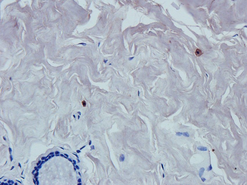 Caspase 3 antibody