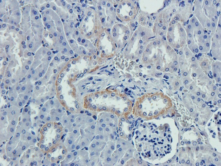 Caspase 3 antibody