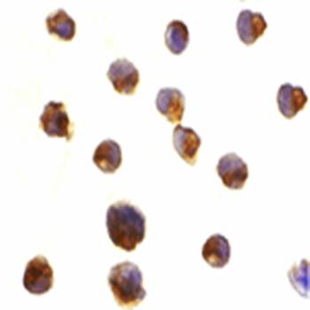 Caspase-6 Antibody
