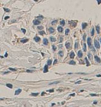 Caspase 8 Rabbit Polyclonal Antibody