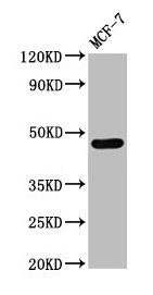 CASQ2 antibody