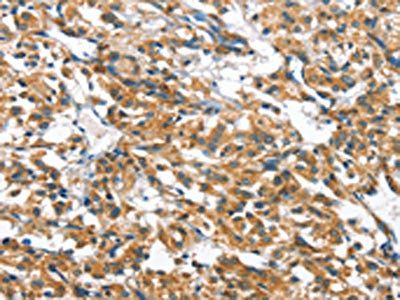 CASQ2 antibody