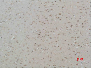 CASR Antibody