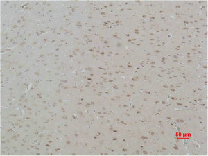 CASR antibody