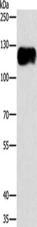 CAST Antibody