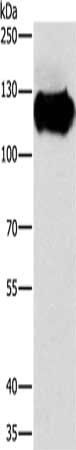 CAST Antibody