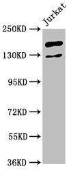 CASZ1 Antibody