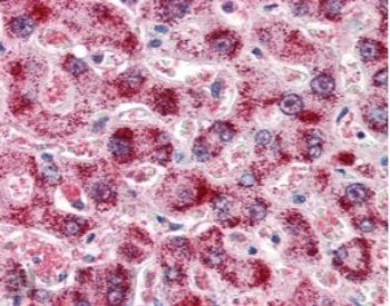 Goat anti-Catalase / CAT Antibody