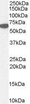 Goat anti-Catalase / CAT Antibody