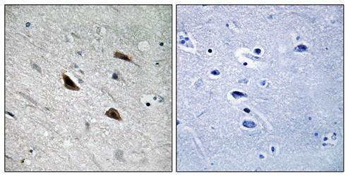 Catenin-β (Phospho-Tyr489) Antibody