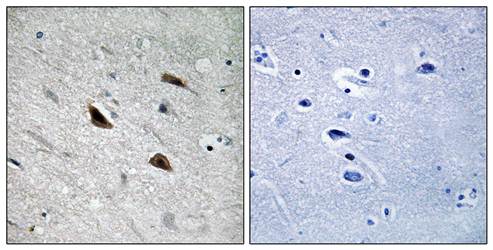 Catenin-beta (phospho-Tyr489) antibody