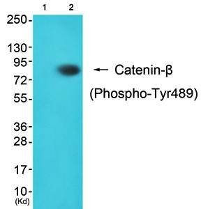 Catenin-beta (phospho-Tyr489) antibody