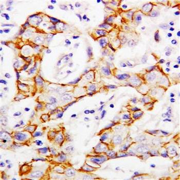 Anti-beta Catenin/CTNNB1 Antibody