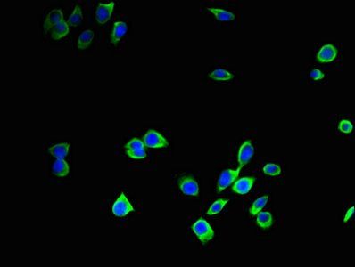 Cathepsin B antibody