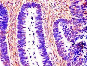 Cathepsin B antibody