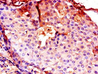 CTSB Antibody