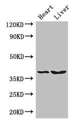 Cathepsin B antibody