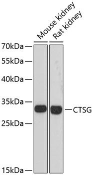 Cathepsin G antibody
