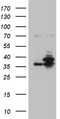 Cathepsin L Antibody