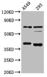 Cathepsin S antibody