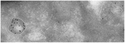 Cathepsin D antibody