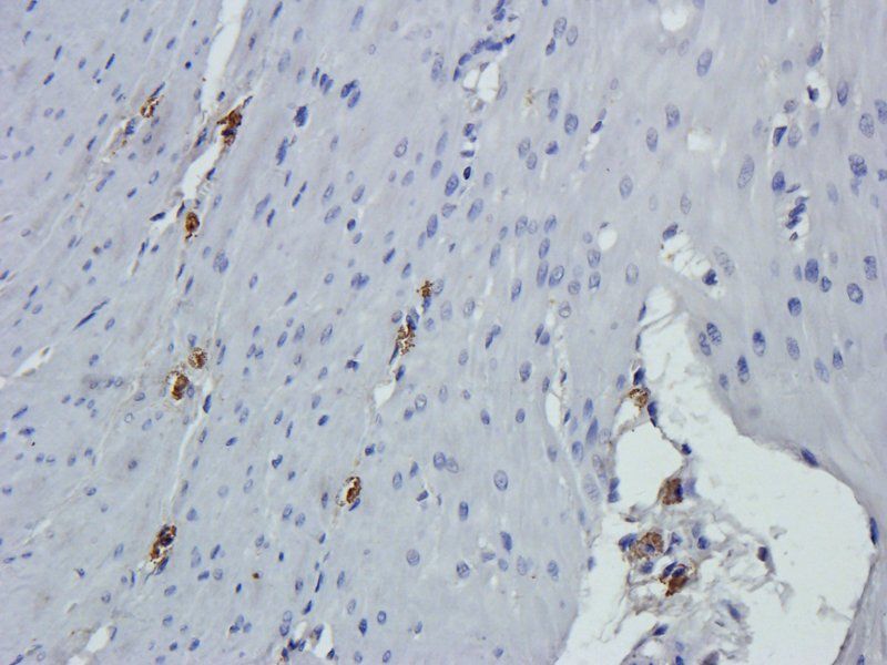 Cathepsin G antibody