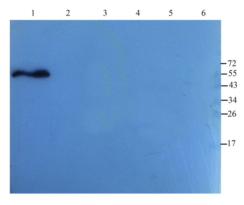 Cathepsin G antibody