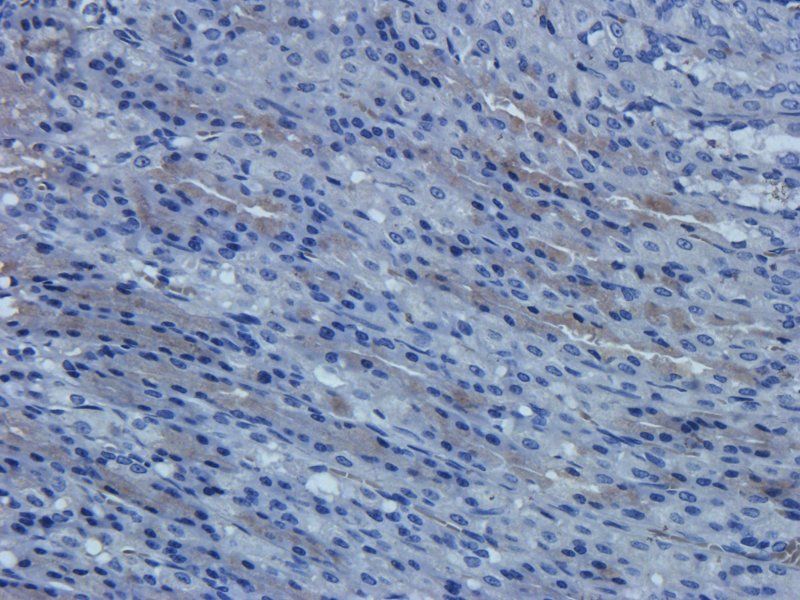 Cathepsin G antibody