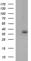 CATIP Antibody