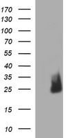 CATIP Antibody