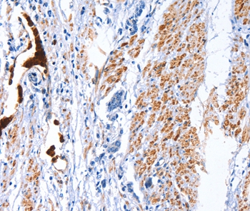 CATSPER1 Antibody