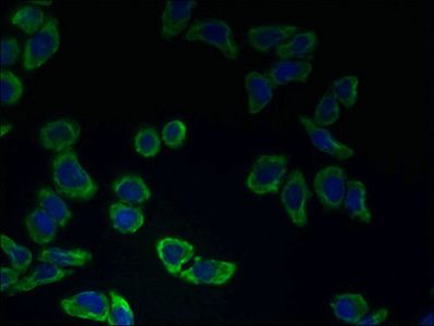 CATSPER2 Antibody