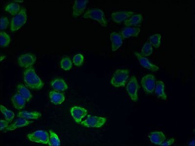 CATSPER2 antibody