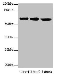 CATSPER2 antibody