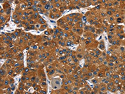 CATSPER3 Antibody